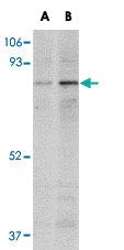 PAB16796 - - Anti-NAA35 Nyúl Poliklonális Antitest - Minden (100 µg)